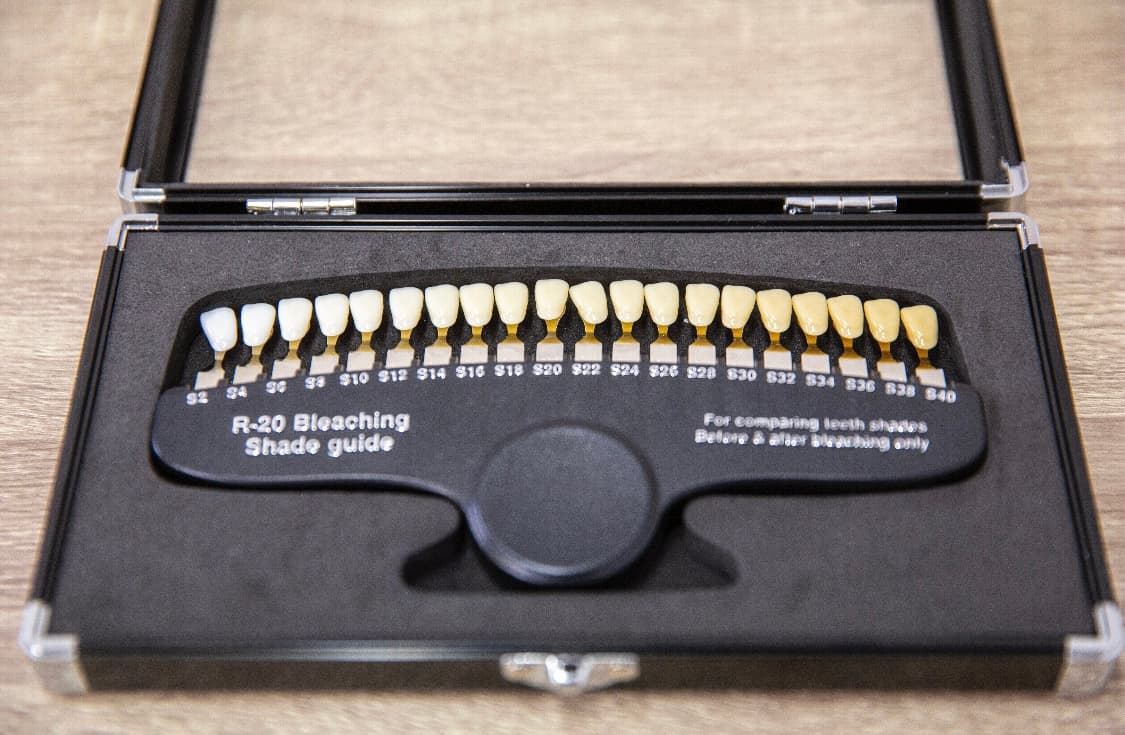 Tandenkleuren-waaier voor kleurbepaling bij Golden Smile
